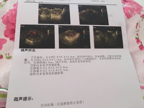 journal_insert_pic_210758541