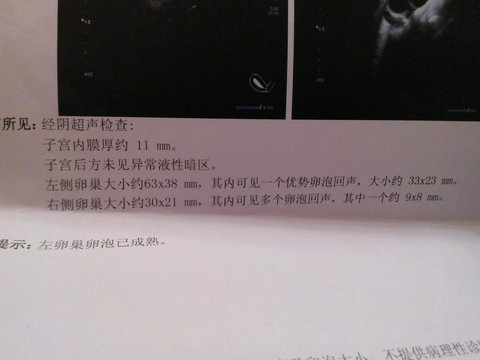 journal_insert_pic_213755781