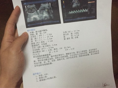 journal_insert_pic_216961053