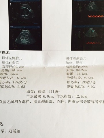 journal_insert_pic_217510614