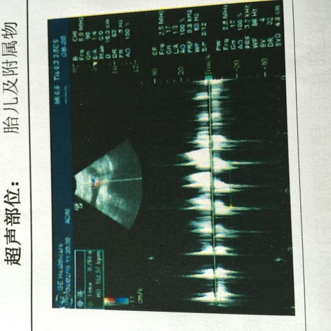 journal_insert_pic_217919907