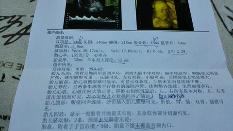 journal_insert_pic_218759105