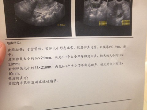journal_insert_pic_223050306