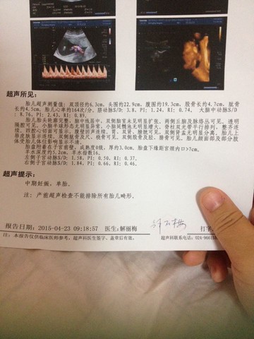 journal_insert_pic_222987934