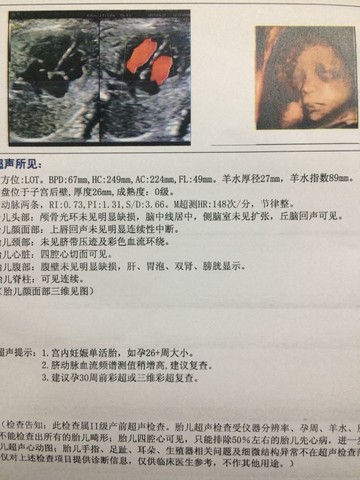 journal_insert_pic_224248998