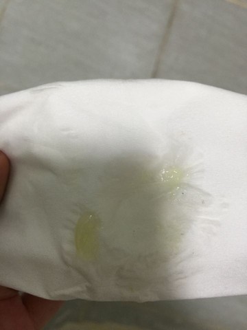 32周出现果冻一样的分泌物