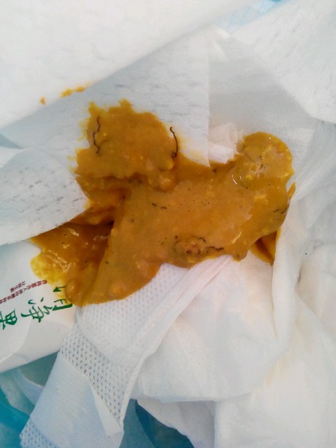 宝宝这几天便便异常,医生说是没消化的香蕉,但我