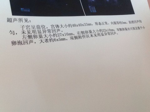 journal_insert_pic_232570222