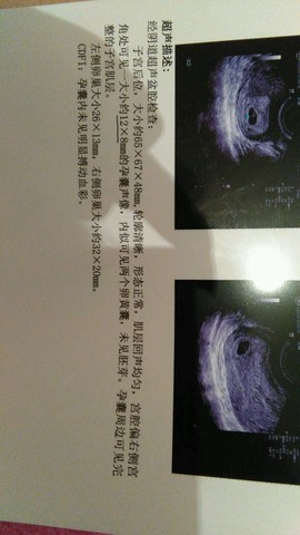 journal_insert_pic_235434724