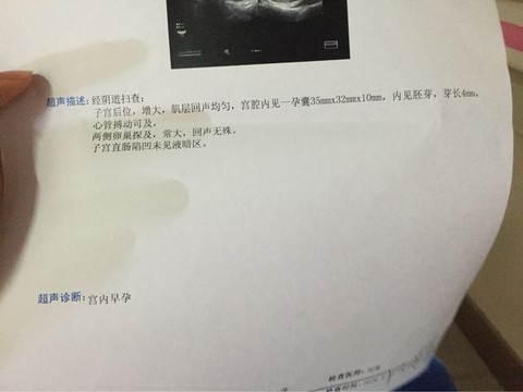journal_insert_pic_235593502