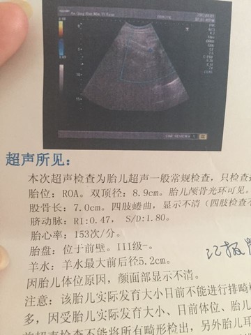 journal_insert_pic_247437027