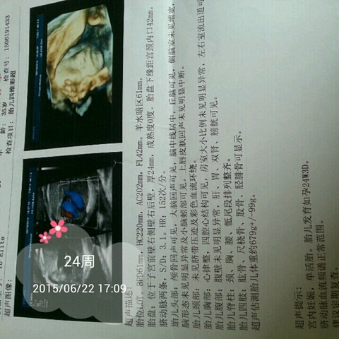 journal_insert_pic_248092832
