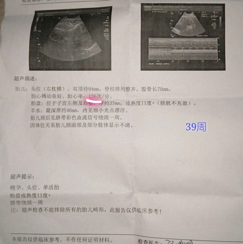 journal_insert_pic_249945538