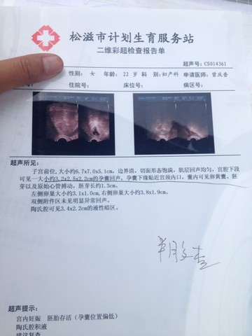 journal_insert_pic_250960869