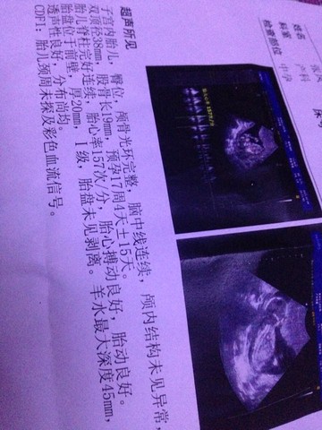 journal_insert_pic_254306778