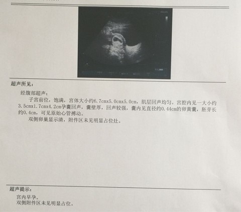 journal_insert_pic_256532157