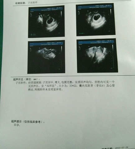 journal_insert_pic_261503511