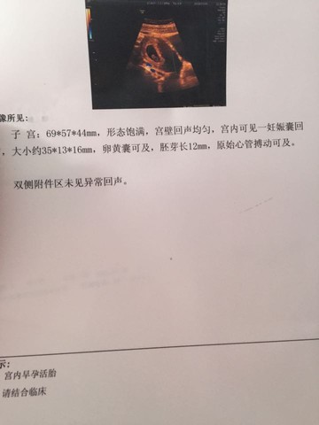 journal_insert_pic_264031792