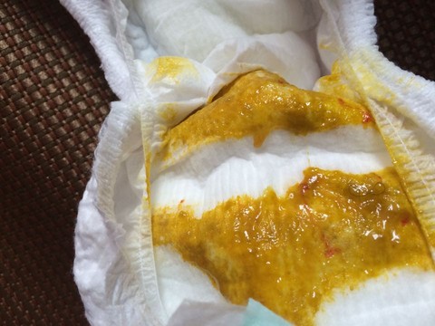 有母乳蛋白过敏还在坚持母乳餵养的吗?求正能量!