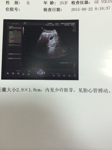 journal_insert_pic_275207466