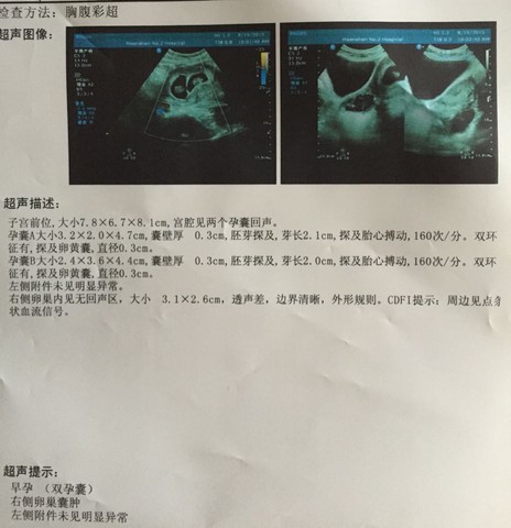 journal_insert_pic_276307169