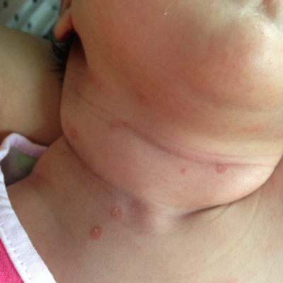 问答 婴儿期0-1岁 爱阳光旳榴莲1个月9天2015-08-24 推荐回答 爱阳光