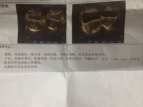 journal_insert_pic_277839814