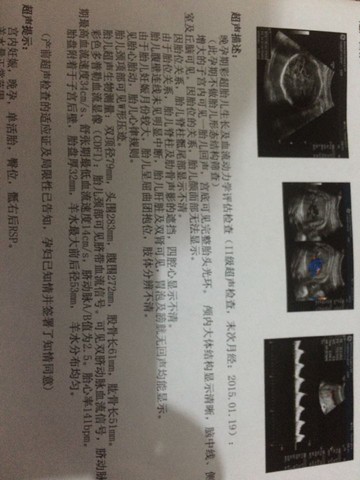 journal_insert_pic_280695340