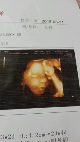 journal_insert_pic_284100179