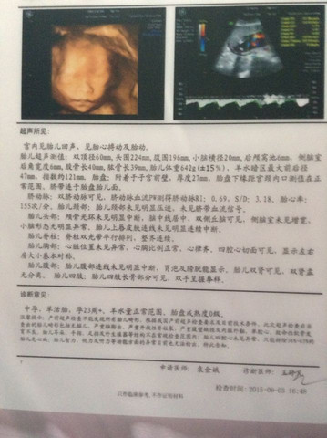 journal_insert_pic_287170896