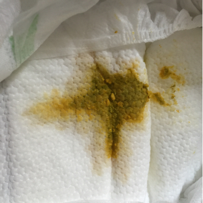纯母乳餵养,之前大便都是黄色的,今天的有点绿色的,这是怎麼回事呢?