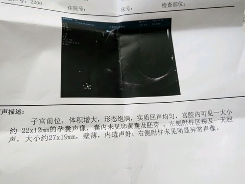 journal_insert_pic_296177890