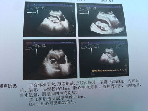 journal_insert_pic_296089802