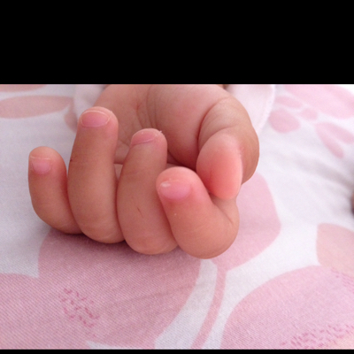 我家宝宝一个手指头的指甲上有白斑,有宝妈知道怎麼回事嘛,谢谢