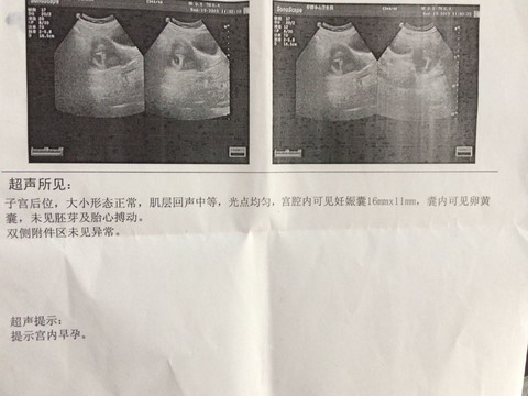 journal_insert_pic_299452468