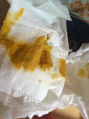 宝宝26天,纯母乳,这是刚拉的粑粑,感觉像水,有细小泡沫,正常吗