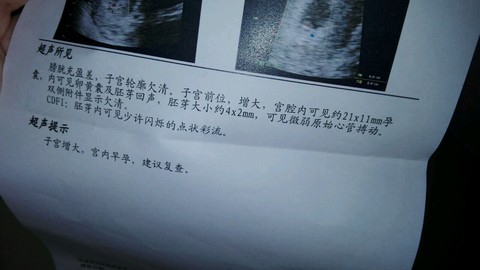 journal_insert_pic_310311685