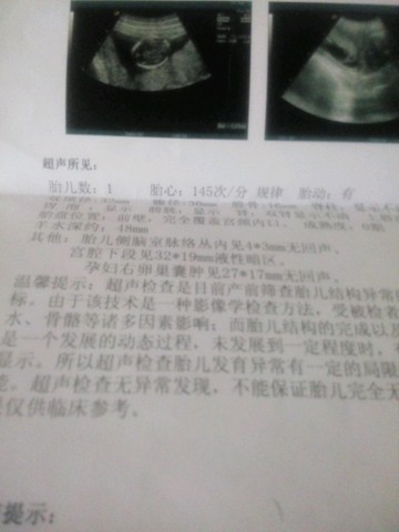 journal_insert_pic_312692792