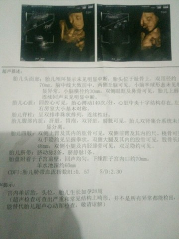 journal_insert_pic_315596147