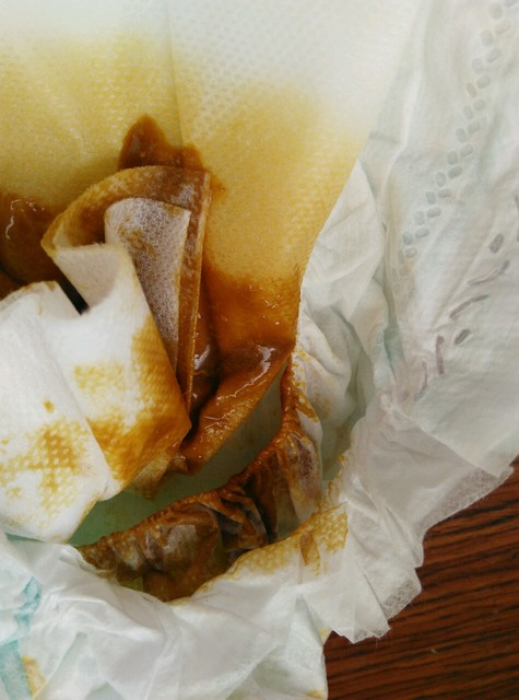 母乳专家答疑第2期:母乳宝宝出生后不同阶段大便知多少?