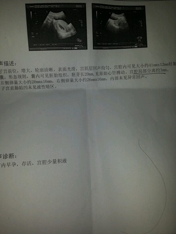 journal_insert_pic_321672853