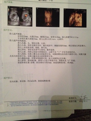 journal_insert_pic_329444547
