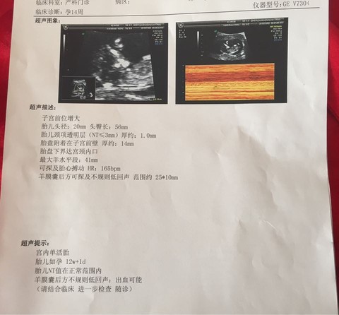 journal_insert_pic_331307390