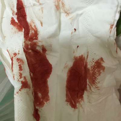 问答 怀孕期 骑士堃堃孕6周1天2015-11-09 推荐回答