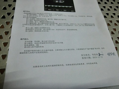journal_insert_pic_336022867