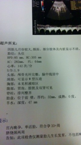 journal_insert_pic_336735012