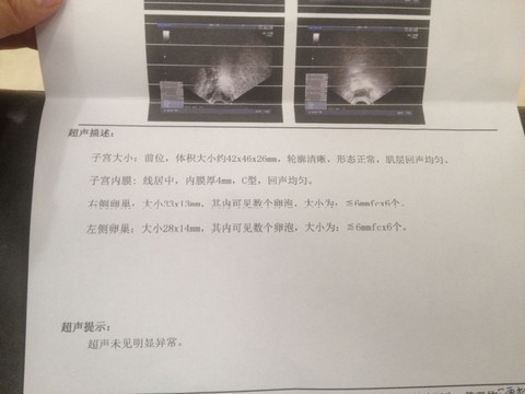 journal_insert_pic_340602914