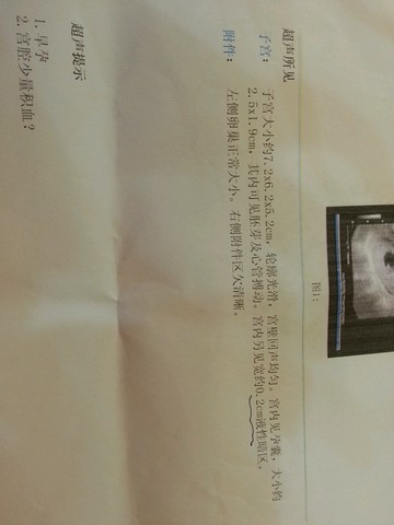 journal_insert_pic_341566146