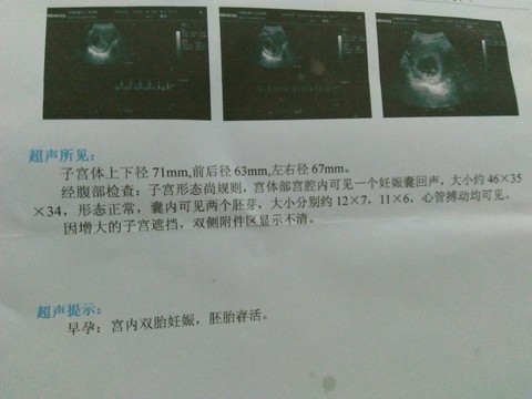 journal_insert_pic_341764684