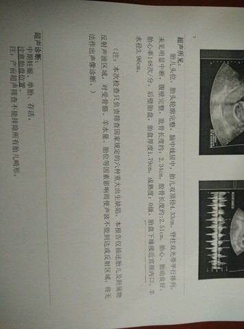 journal_insert_pic_345695552